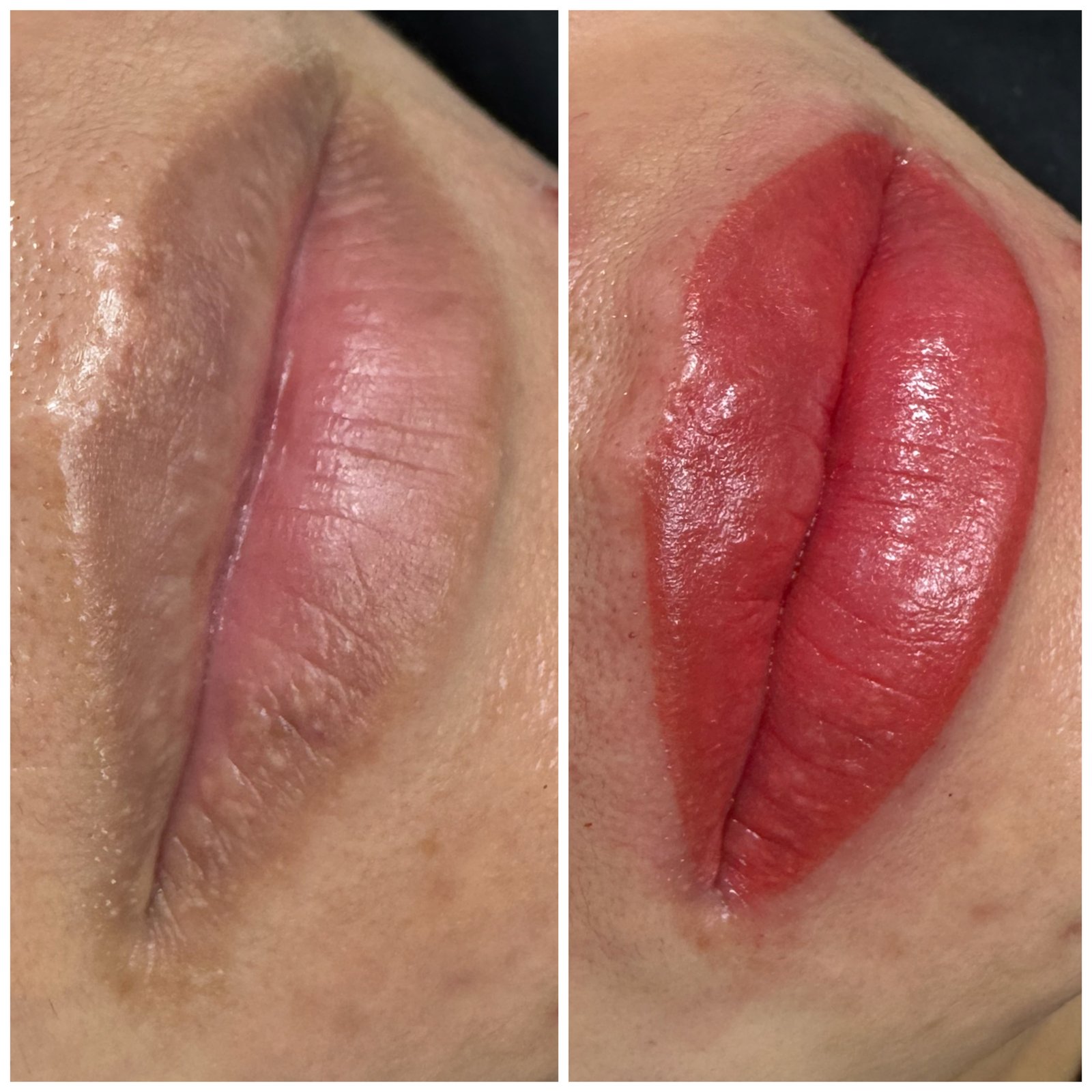 Lip neutralization before and after for dark cool lips Houston